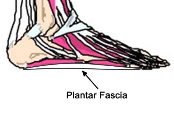 C:\Users\user\Desktop\PTAG Foot and Ankle course\PTAG Course images\plantar fascia.jpg